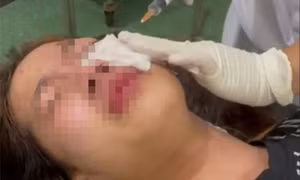 Điều tra nhóm thanh niên xịt hơi cay vào mặt nữ sinh