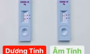  Hướng dẫn lấy mẫu, thực hiện test nhanh SARS-CoV-2 tại nhà