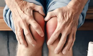 Những lầm tưởng phổ biến về bệnh viêm khớp mà bạn nên biết