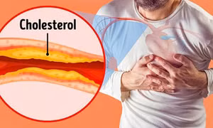4 loại thực phẩm tốt nhất giúp giảm mức cholesterol