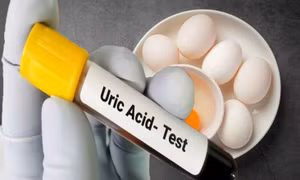 Lợi ích của việc ăn trứng đối với người axit uric cao