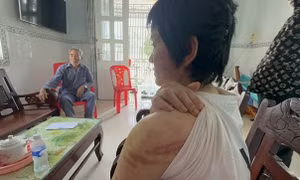 Người chồng bị tố bạo hành vợ bầu 7 tháng như thời trung cổ khai gì?
