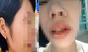Chỉ đạo khẩn vụ phụ huynh xông vào nhà đánh cô giáo vì con bị hạnh kiểm trung bình