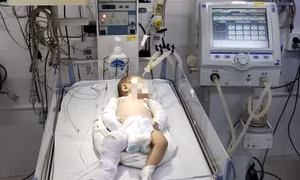 Bé gái hơn 2 tháng tuổi bị bạo hành dã man được xuất viện