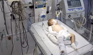 Trẻ 3 tháng tuổi bị mẹ và cha dượng hành hạ đến gãy xương