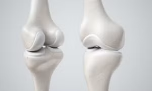 Phát triển sụn khớp nhân tạo có tính ứng dụng cao