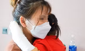 Tự rút sạc điện thoại, bé gái 29 tháng tuổi bị điện giật cháy đen lòng bàn tay