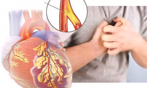 Một số lưu ý khi dùng thuốc điều trị triệu chứng suy tim