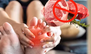 Các loại thực phẩm người bị gout nên kiêng để giảm axit uric