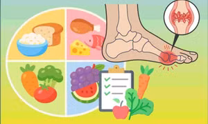 Thực phẩm giúp kiểm soát axit uric trong cuộc sống hằng ngày