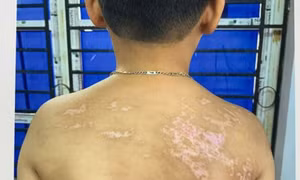 Bắt tạm giam người cha bạo hành con trai hơn 7 tuổi ở Phú Thọ
