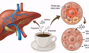 Uống cà phê đúng cách để gan khỏe hơn mỗi ngày