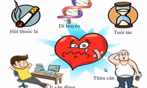 7 cách giúp trái tim khỏe mạnh