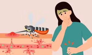 Những triệu chứng cảnh báo bệnh chikungunya bạn không nên bỏ qua