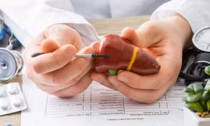 5 nguyên nhân phổ biến gây tăng men gan
