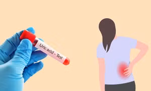 Nguyên nhân âm thầm khiến axit uric tăng cao ở người trẻ tuổi