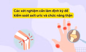 Các xét nghiệm cần làm định kỳ để kiểm soát axit uric và chức năng thận