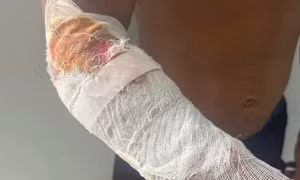 Cá sấu của khu du lịch sổng chuồng, cắn người dân bên sông