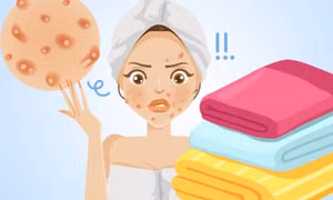 Khăn tắm bẩn và những ảnh hưởng không ngờ đến làn da