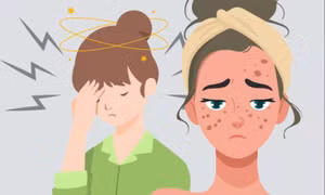 Căng thẳng và mối liên hệ mật thiết đến sức khỏe làn da