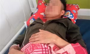 Nhân viên bảo vệ rừng phải nhập viện sau trận đòn hội đồng của 30 người