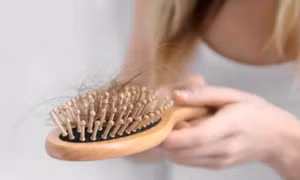 Mắc bệnh đái tháo đường có gây rụng tóc không?