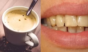 Cách uống cà phê giúp bảo vệ răng miệng