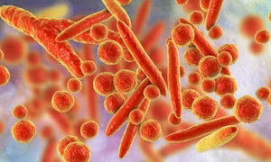 Hàng loạt trẻ viêm phổi Mycoplasma nhập viện, bác sĩ chỉ dấu hiệu phát hiện bệnh