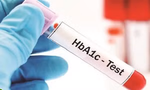 6 ghi nhớ giúp người đái tháo đường và tiền đái tháo đường kiểm soát chỉ số HbA1C