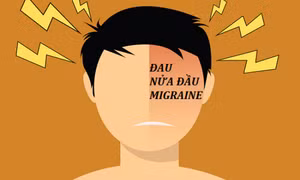 3 yếu tố khiến gia tăng mắc bệnh đau nửa đầu