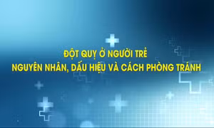 Đột quỵ ở người trẻ: Nguyên nhân, dấu hiệu và cách phòng tránh