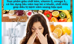 10 loại thực phẩm cần tránh khi bị viêm xoang