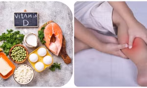 Thiếu vitamin D gây bệnh gì?