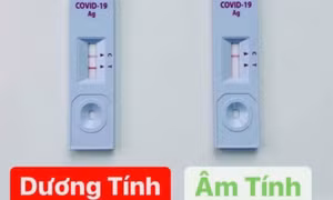 Test nhanh COVID-19 một vạch: Hiện C hay T mới đúng?