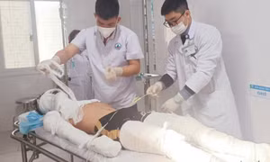 Nam sinh lớp 11 bỏng toàn thân do đốt pháo hoa