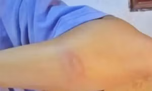 Thầy giáo ở Nghệ An đánh bầm tay nữ sinh