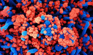 Mỹ phát triển phương pháp xác định các đột biến của virus SARS-CoV-2
