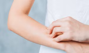 Bị dị ứng thời tiết nên làm gì?