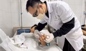 Pháo nổ khiến 141 người phải nhập viện sau 4 ngày nghỉ Tết