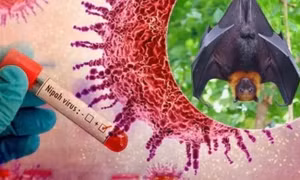 Bộ Y tế chính thức ban hành phác đồ điều trị virus Nipah