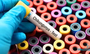 WHO cảnh báo nguy cơ lây lan cao của virus Chikungunya