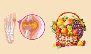 Chống lại axit uric cao nhờ những loại trái cây quen thuộc giàu vitamin B12
