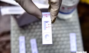 Có triệu chứng nghi ngờ mắc COVID-19, cần test nhanh không?