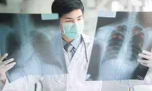 Ung thư di căn vị trí nào đáng sợ nhất?