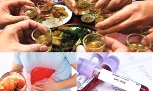 Chế độ ăn kiêng cho người bị bệnh gút