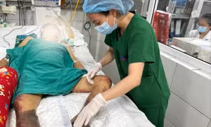 Cảnh giác với thực phẩm độc hại dịp Tết