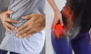 Triệu chứng các giai đoạn của bệnh thoái hóa khớp hông