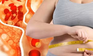 Cholesterol ảnh hưởng đến việc quản lý cân nặng như thế nào?