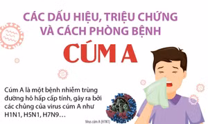 Các dấu hiệu, triệu chứng và cách phòng bệnh cúm A