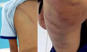 Khởi tố vụ án mẹ kế đánh con chồng